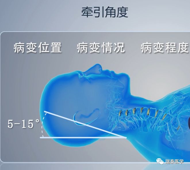 頭暈、眼花,半夜睡覺脖子還老不舒服?這是病,得治! 頭暈、眼花,半夜睡覺脖子還老不舒服?這是病,得治!