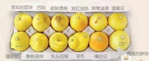 数字化摄影是什么检查好消息！助力乳腺癌早期诊断 青田人民医院数字化乳腺X线机正式投入使用_https://www.jmylbn.com_新闻资讯_第7张