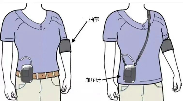 动态血压怎么佩带【科普知识】动态血压监测，更可靠的血压测量方式_https://www.jmylbn.com_新闻资讯_第5张