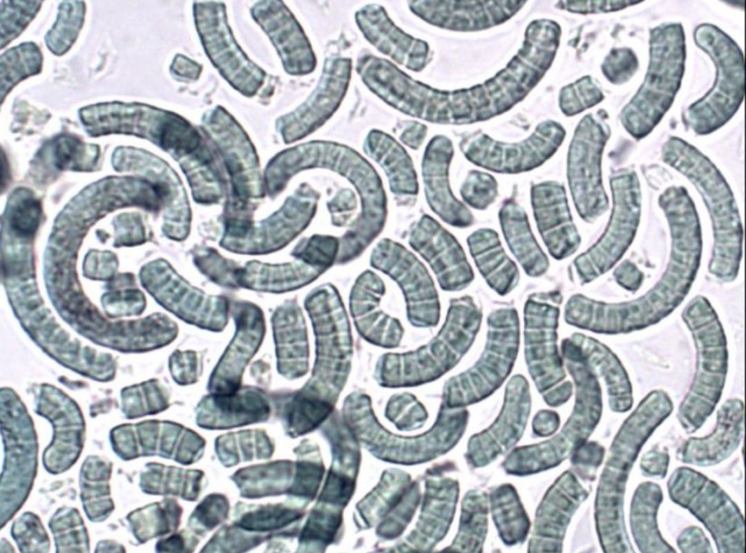 螺旋藻结构模式图图片