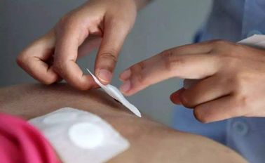 伏天已至，关于三伏贴你想知道的都在这