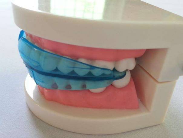 下颌后缩(下巴后悬); 牙齿长得不齐; 黑眼圈(所以口呼吸的孩子睡眠