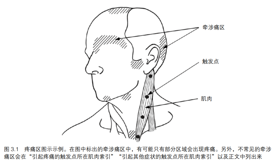 经常头痛 试试自我松解 胸锁乳突肌触发点按摩 健身小食堂 微信公众号文章阅读 Wemp