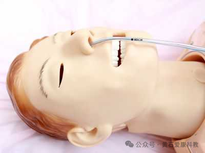 什么 手术 洗胃洗胃术_https://www.jmylbn.com_新闻资讯_第2张