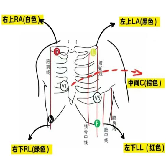 心电监护仪有什么作用【专家讲科普】赵利娟：心电监护仪：患者生命体征的“守护者”_https://www.jmylbn.com_新闻资讯_第4张