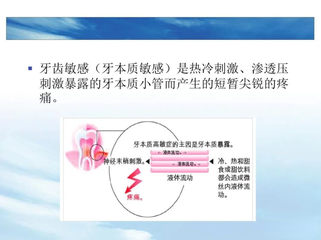 树脂充填后敏感的原因，这几点不可忽略！