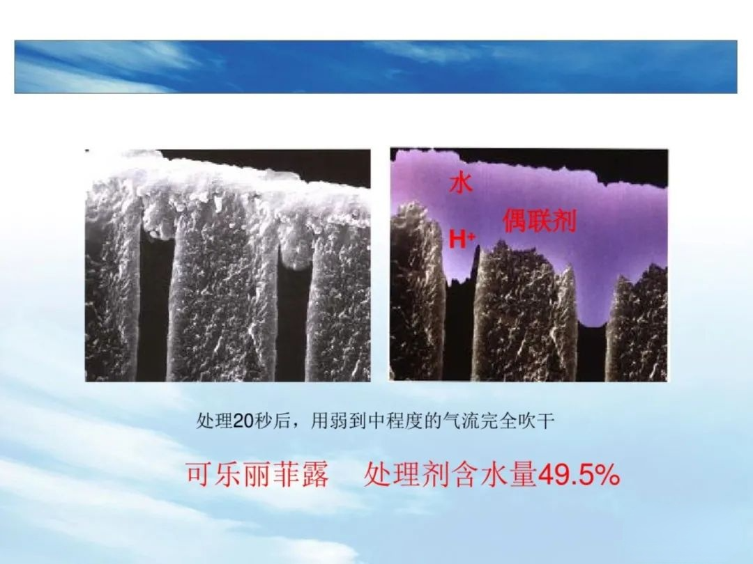 树脂充填后敏感的原因，这几点不可忽略！