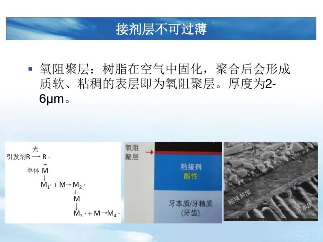 树脂充填后敏感的原因，这几点不可忽略！