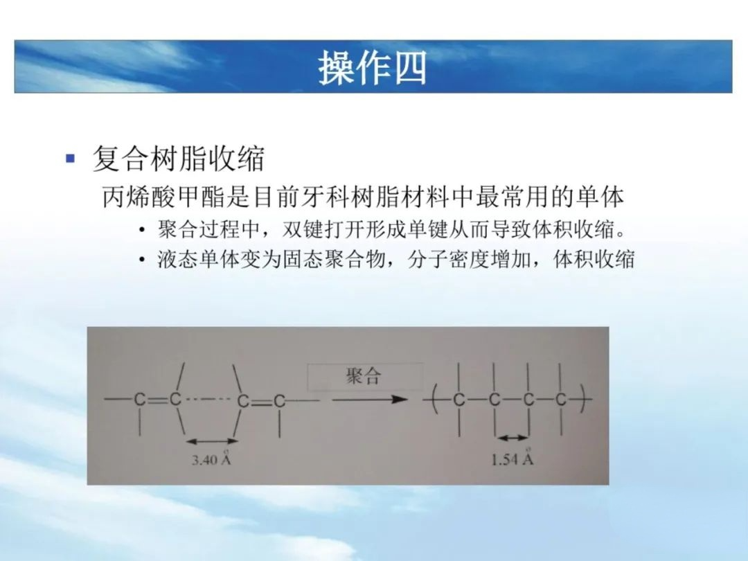 树脂充填后敏感的原因，这几点不可忽略！
