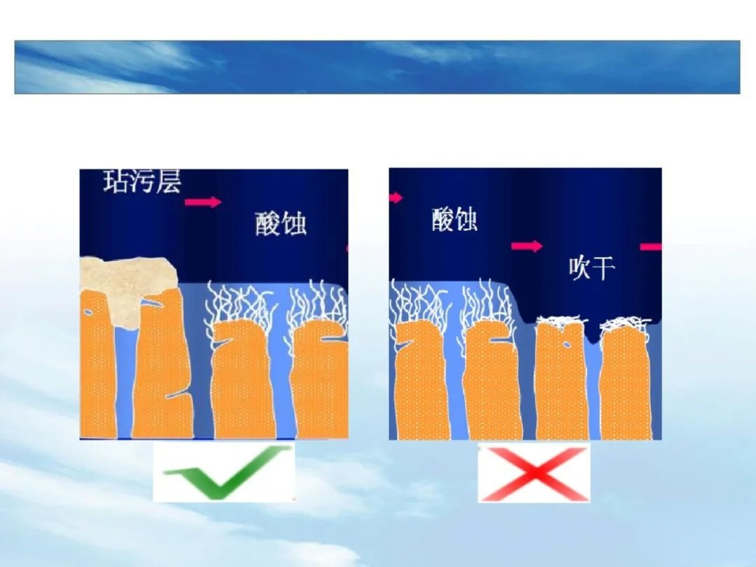 树脂充填后敏感的原因，这几点不可忽略！