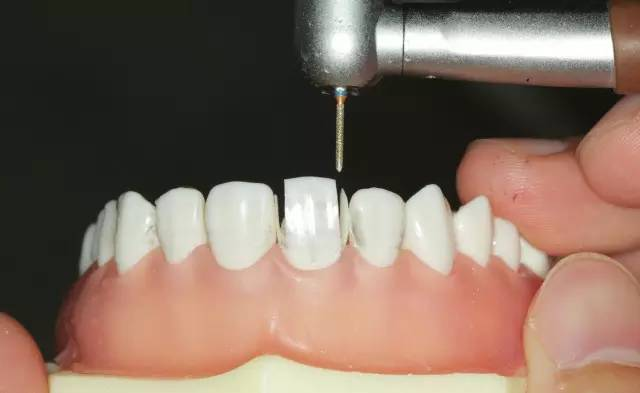 牙科材料硅胶怎么用牙体预备步骤详解，手把手教你制作硅橡胶导板！_https://www.jmylbn.com_新闻资讯_第15张