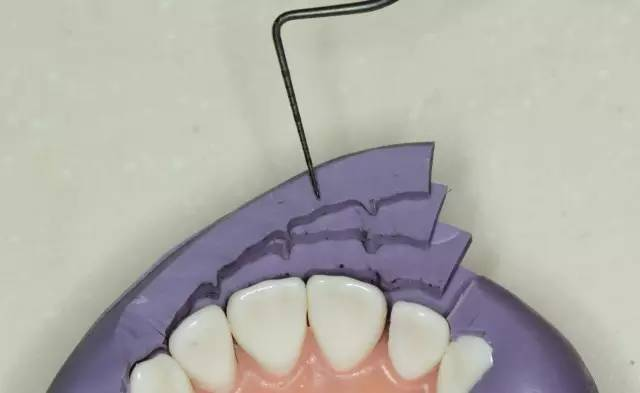 牙科材料硅胶怎么用牙体预备步骤详解，手把手教你制作硅橡胶导板！_https://www.jmylbn.com_新闻资讯_第13张