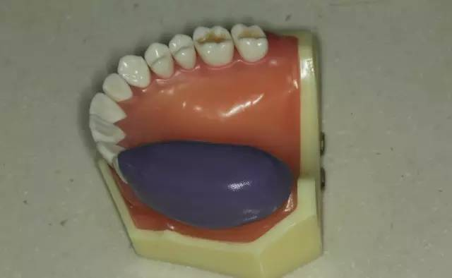 牙科材料硅胶怎么用牙体预备步骤详解，手把手教你制作硅橡胶导板！_https://www.jmylbn.com_新闻资讯_第24张