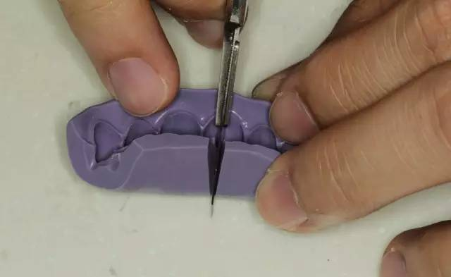 牙科材料硅胶怎么用牙体预备步骤详解，手把手教你制作硅橡胶导板！_https://www.jmylbn.com_新闻资讯_第6张