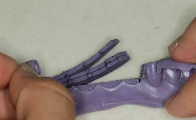 牙科材料硅胶怎么用牙体预备步骤详解，手把手教你制作硅橡胶导板！_https://www.jmylbn.com_新闻资讯_第12张