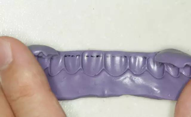 牙科材料硅胶怎么用牙体预备步骤详解，手把手教你制作硅橡胶导板！_https://www.jmylbn.com_新闻资讯_第9张