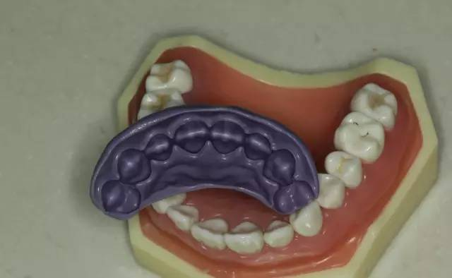 牙科材料硅胶怎么用牙体预备步骤详解，手把手教你制作硅橡胶导板！_https://www.jmylbn.com_新闻资讯_第5张