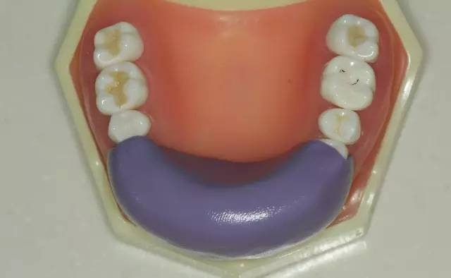 牙科材料硅胶怎么用牙体预备步骤详解，手把手教你制作硅橡胶导板！_https://www.jmylbn.com_新闻资讯_第4张