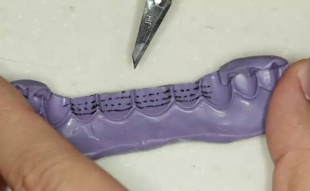 牙科材料硅胶怎么用牙体预备步骤详解，手把手教你制作硅橡胶导板！_https://www.jmylbn.com_新闻资讯_第11张