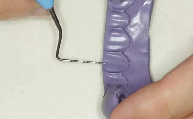 牙科材料硅胶怎么用牙体预备步骤详解，手把手教你制作硅橡胶导板！_https://www.jmylbn.com_新闻资讯_第8张