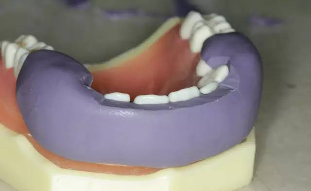 牙科材料硅胶怎么用牙体预备步骤详解，手把手教你制作硅橡胶导板！_https://www.jmylbn.com_新闻资讯_第10张