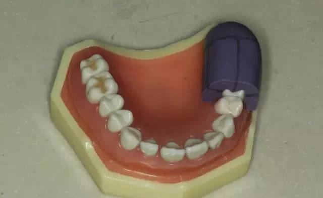 牙科材料硅胶怎么用牙体预备步骤详解，手把手教你制作硅橡胶导板！_https://www.jmylbn.com_新闻资讯_第26张