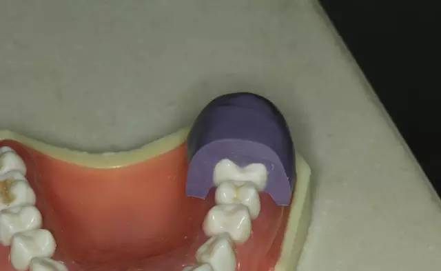 牙科材料硅胶怎么用牙体预备步骤详解，手把手教你制作硅橡胶导板！_https://www.jmylbn.com_新闻资讯_第27张