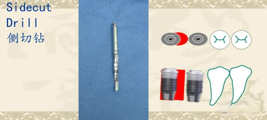 甲状腺拉钩怎么用早读 ｜ 盘点口腔种植手术器械，一文告诉你怎么使用！_https://www.jmylbn.com_新闻资讯_第19张