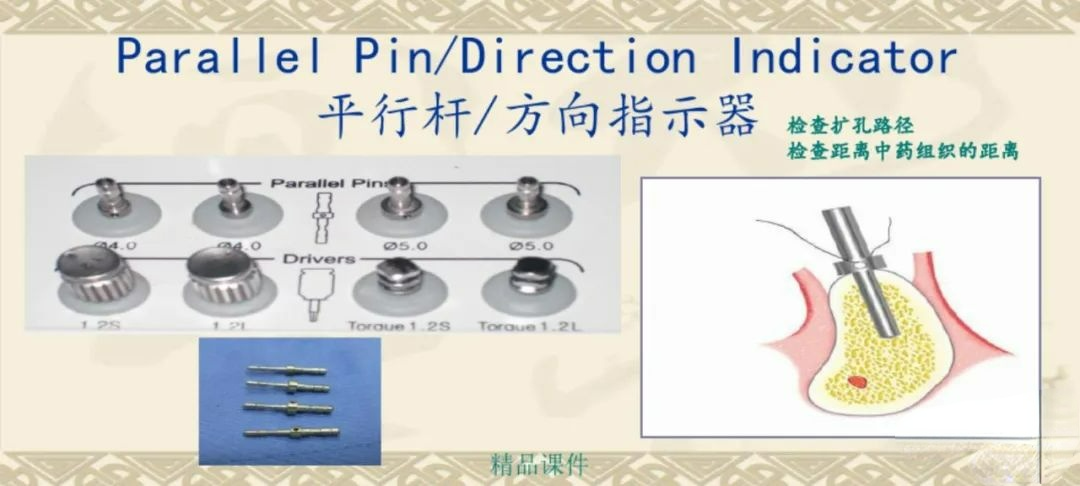 甲状腺拉钩怎么用早读 ｜ 盘点口腔种植手术器械，一文告诉你怎么使用！_https://www.jmylbn.com_新闻资讯_第29张