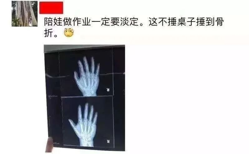 孩子写作业磨蹭，妈妈差点心肌梗塞：提高作业效率，缓解亲子关系