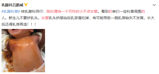 喂4岁女童喝发酵数年的冬瓜水、“放血疗法”、女孩不挤乳头会内陷？孩子想活命一定要避坑！