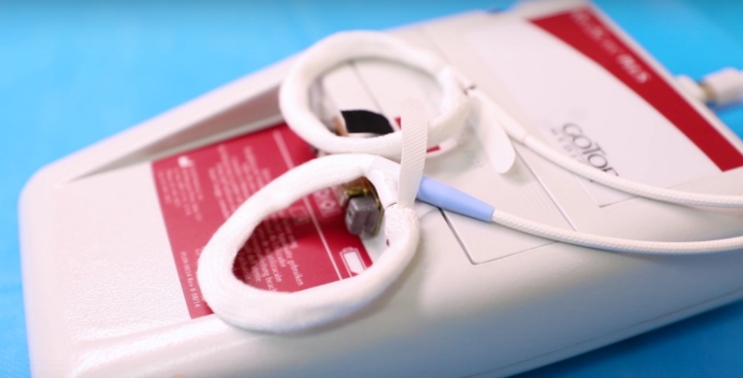 什么是性功能检测仪“真假”阳痿一测便知!博大Rigiscan阴茎硬度检测仪助你全面了解性功能障碍的病因_https://www.jmylbn.com_新闻资讯_第4张