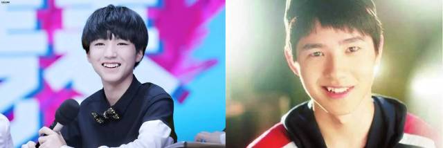 可爱的虎牙为什么最不能拔？