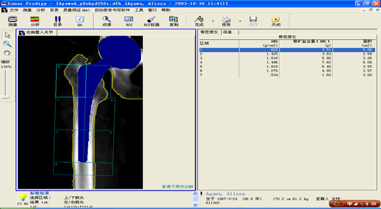 双能x骨密度检测仪为什么非得输入体重身高双能X线（DXA）骨密度检测及报告解读_https://www.jmylbn.com_新闻资讯_第11张