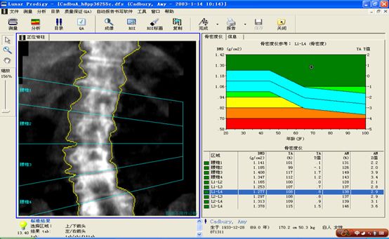 双能x骨密度检测仪为什么非得输入体重身高双能X线（DXA）骨密度检测及报告解读_https://www.jmylbn.com_新闻资讯_第10张