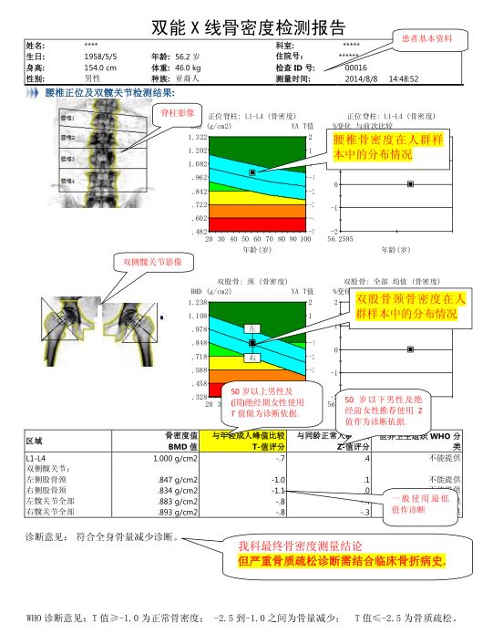 双能x骨密度检测仪为什么非得输入体重身高双能X线（DXA）骨密度检测及报告解读_https://www.jmylbn.com_新闻资讯_第12张
