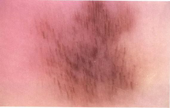 电子皮肤镜有什么用松医电子皮肤镜正式投入使用_https://www.jmylbn.com_新闻资讯_第6张