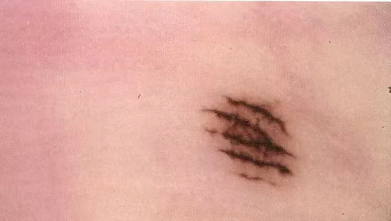 电子皮肤镜有什么用松医电子皮肤镜正式投入使用_https://www.jmylbn.com_新闻资讯_第4张