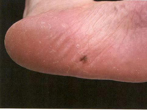 电子皮肤镜有什么用松医电子皮肤镜正式投入使用_https://www.jmylbn.com_新闻资讯_第5张