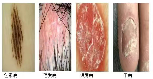 电子皮肤镜有什么用松医电子皮肤镜正式投入使用_https://www.jmylbn.com_新闻资讯_第8张