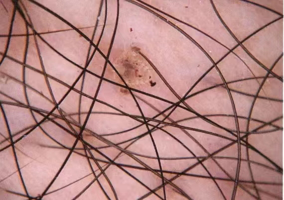 电子皮肤镜有什么用松医电子皮肤镜正式投入使用_https://www.jmylbn.com_新闻资讯_第7张