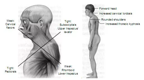 新品预告：SOLOVE水漾·蒸汽热敷肩颈贴上市