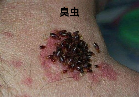 味道臭名声更臭的臭虫