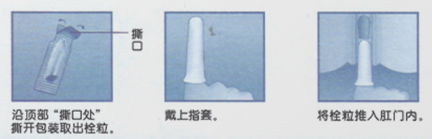 痔疮给药器怎么用用痔疮药前，先把说明书认真读一遍啊喂！_https://www.jmylbn.com_新闻资讯_第16张