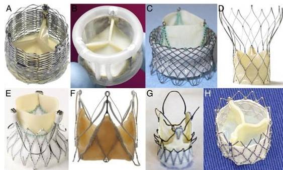 我的天心脏支架心脏瓣膜人工血管原来长这样