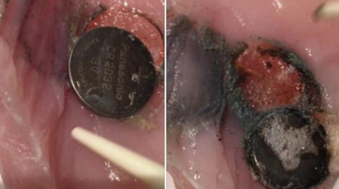 华人注意：这些圣诞礼物竟藏致命威胁，已有人胃被烧穿因此丧命（组图） - 11