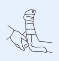 医用夹板怎么使用新品速递丨驼人集团医用高分子夹板_https://www.jmylbn.com_新闻资讯_第6张