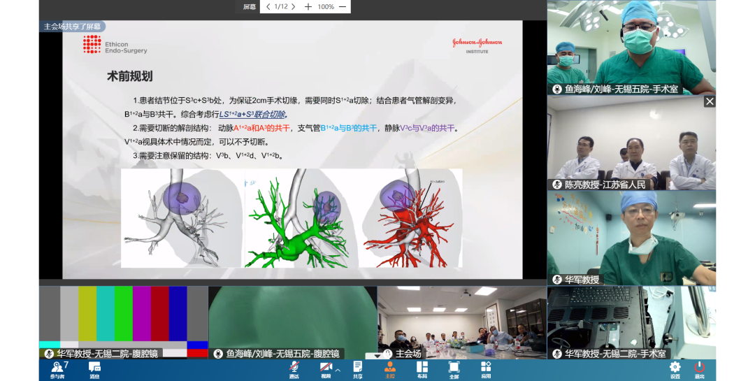 什么是数字肺线上直播肺亚段切除手术 多地数字化远程合作研讨_https://www.jmylbn.com_新闻资讯_第2张