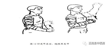 上肢怎么康复【正中医｜科普】上肢骨折术后如何正确的进行康复锻炼_https://www.jmylbn.com_新闻资讯_第15张