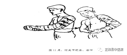 上肢怎么康复【正中医｜科普】上肢骨折术后如何正确的进行康复锻炼_https://www.jmylbn.com_新闻资讯_第14张